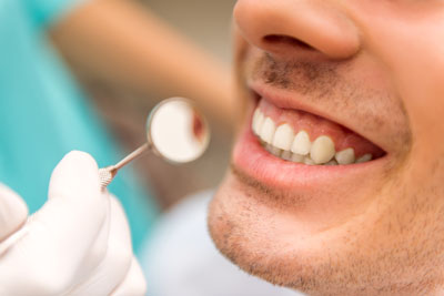 Find A Dentist In Visalia To Answer Your Questions