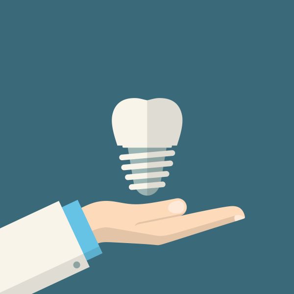 What Materials Are Mini Dental Implants Made Of?