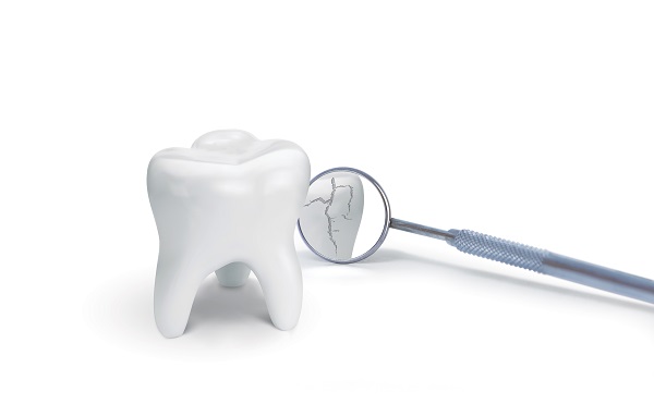 What Happens When A Cracked Tooth Goes Untreated?