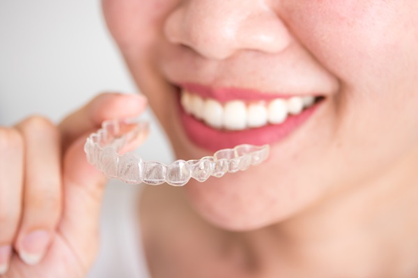 Five Advantages Of Clear Aligners