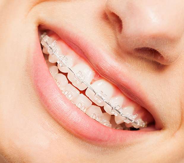 Visalia Invisible Orthodontics