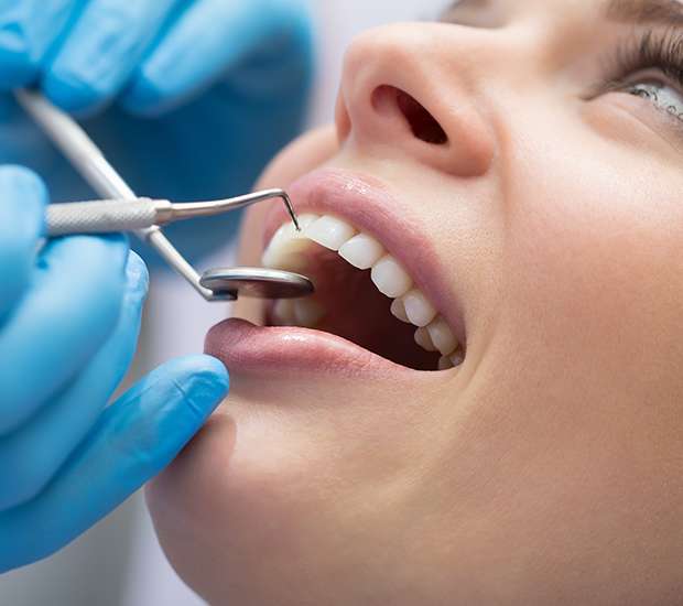 Visalia Dental Bonding