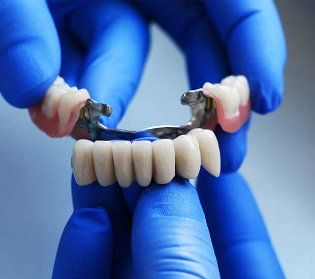 Visalia Dental Bridges