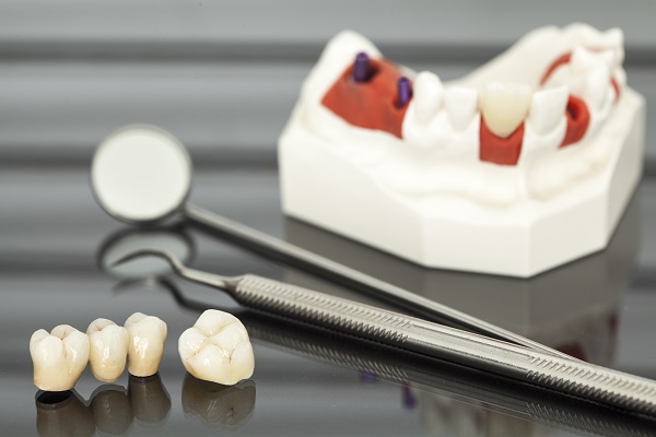 Dental Crown To Restore A Damaged Tooth