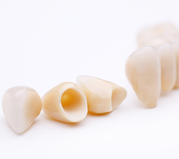 Visalia Dental Crowns and Dental Bridges