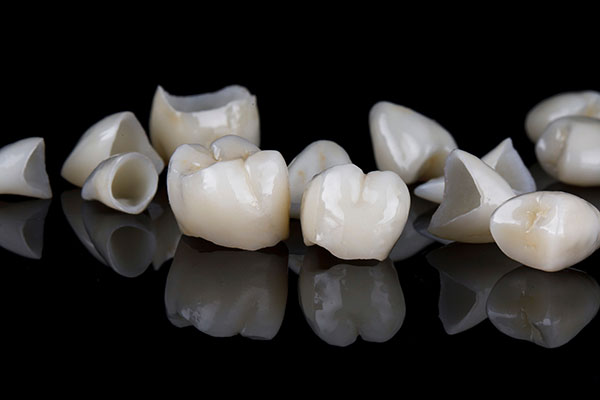 What Are the Differences Between a Dental Crown and a Dental Veneer? from Visalia Care Dental in Visalia, CA