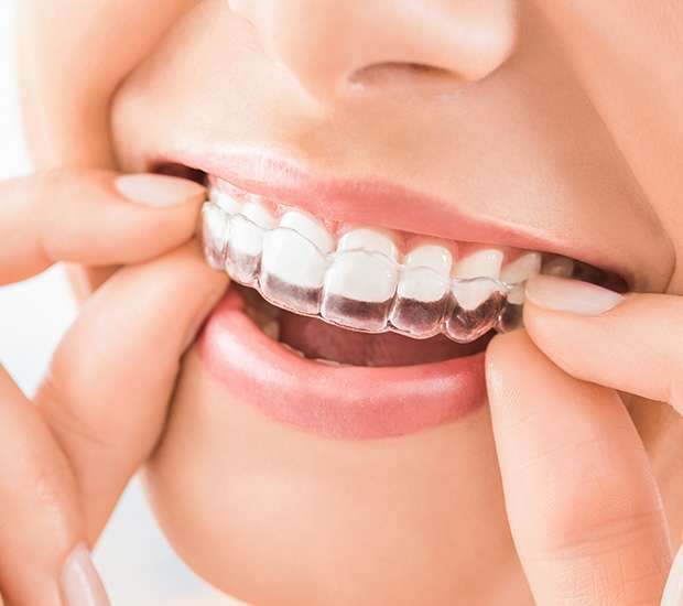 Visalia Does Invisalign® Really Work?