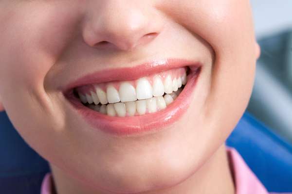 A General Dentist Discusses the Benefits of Tooth Straightening from Visalia Care Dental in Visalia, CA