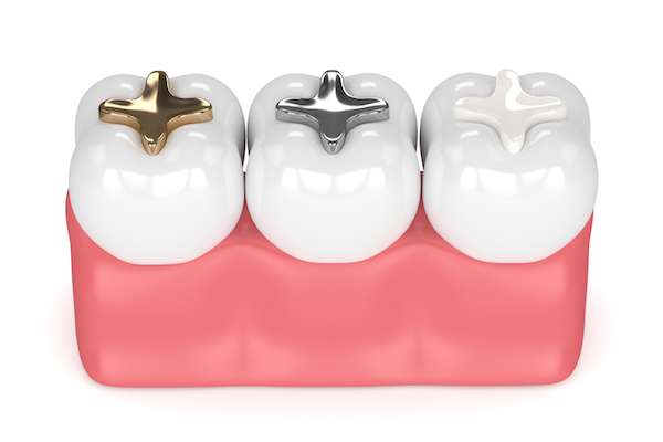 A General Dentist Discusses Different Filling Options from Visalia Care Dental in Visalia, CA