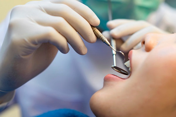 General Dentistry Restoration For A Chipped Tooth