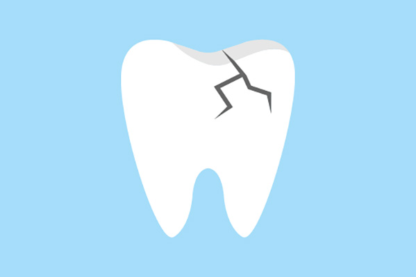 General Dentistry Restoration Options for a Damaged Tooth from Visalia Care Dental in Visalia, CA