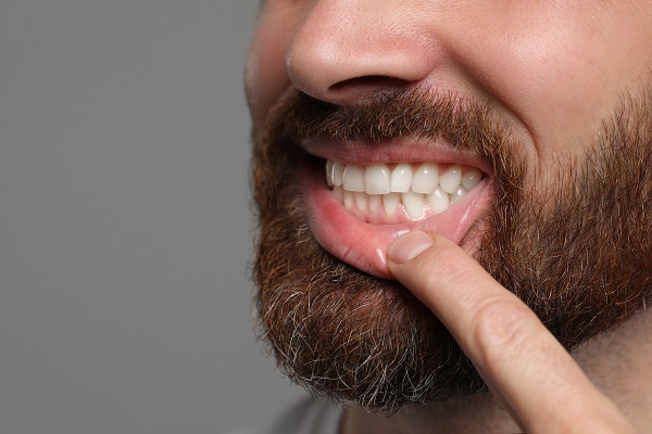 What You Should Know About Gum Disease