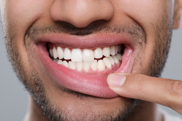 Is Gum Disease Preventable?