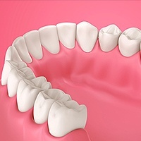 Visalia Gum Disease