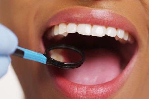 How a General Dentist Treats Cavities from Visalia Care Dental in Visalia, CA