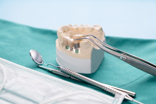Implant Supported Dentures Visalia, CA