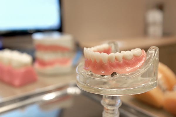 Tips To Extend The Longevity Of Implant Supported Dentures