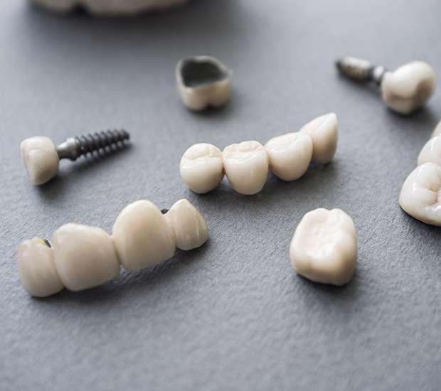 Visalia The Difference Between Dental Implants and Mini Dental Implants