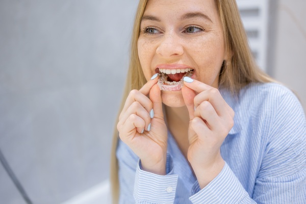 Invisalign Treatment Journey: Step By Step From Consultation To Retainers