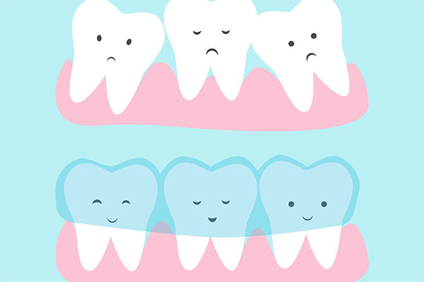 Invisalign Treatment Benefits for Teens from Visalia Care Dental in Visalia, CA