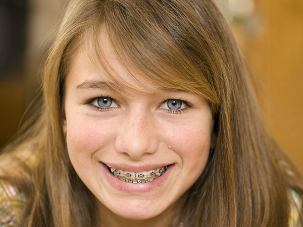 What Age Is Best For Orthodontics For Kids?