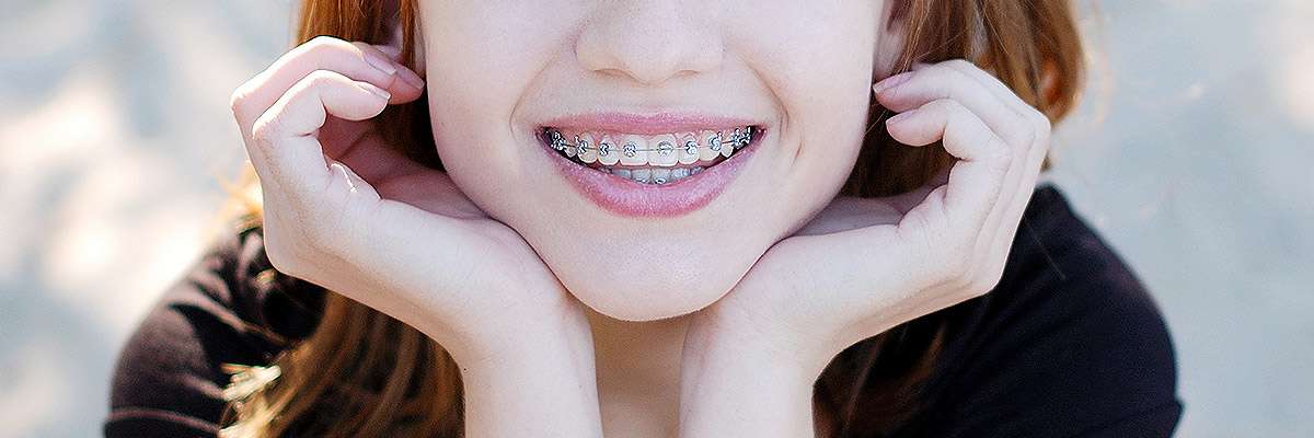 Visalia Orthodontics