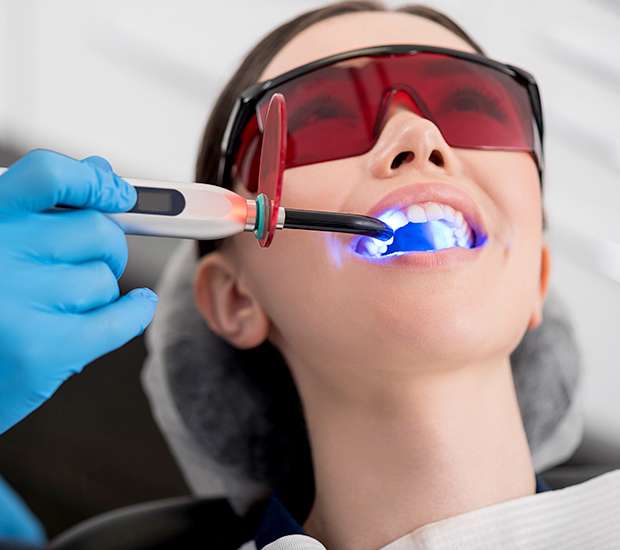 Visalia Professional Teeth Whitening