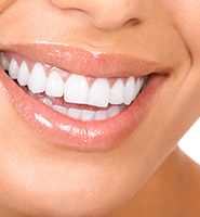 Teeth Whitening Services Visalia, CA
