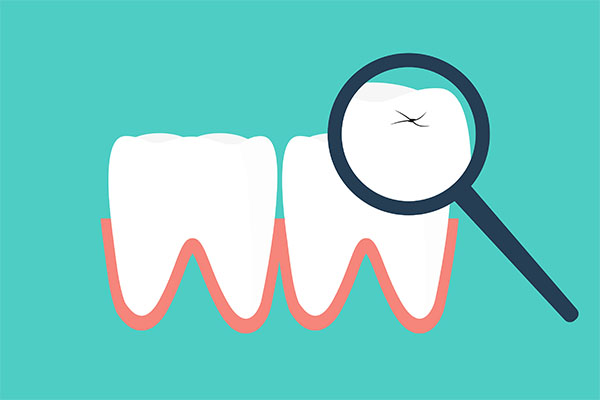 Four Tips for Making Your Dental Crowns Last from Visalia Care Dental in Visalia, CA