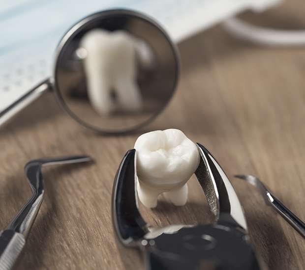 Visalia When Is a Tooth Extraction Necessary